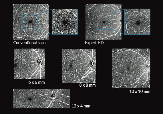 Angio Expert HD Software