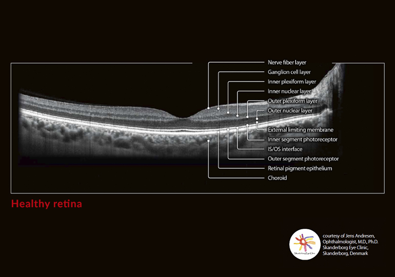 Going beyond the surface