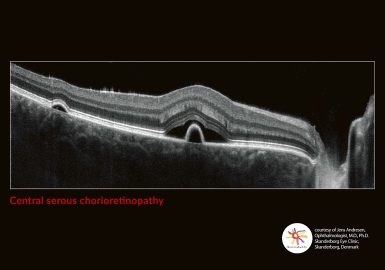 Going beyond the surface